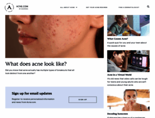 acne.com screenshot