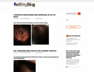 baldingblog.com screenshot