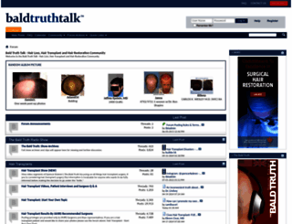 baldtruthtalk.com screenshot