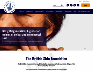britishskinfoundation.org.uk screenshot