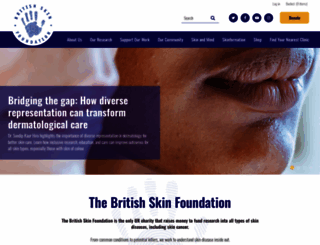 britishskinfoundation.org.uk screenshot