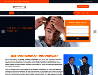 chandigarhhairtransplantation.com screenshot