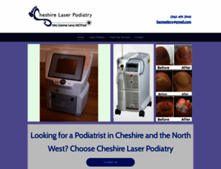 cheshire-laser-podiatry.co.uk screenshot