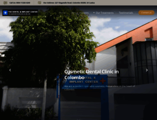 dentalimplantcenter.lk screenshot
