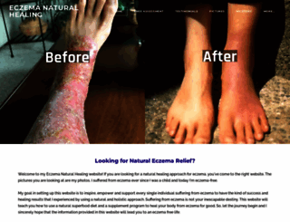 eczema-natural-healing.com screenshot