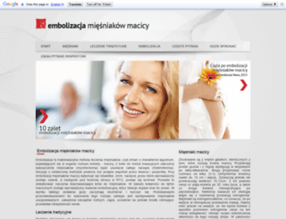 embolizacjamiesniakowmacicy.pl screenshot