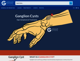 ganglioncysts.com screenshot