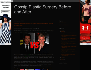gossipplasticsurgery.blogspot.ro screenshot