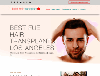 hairtransplantslosangeles.com screenshot