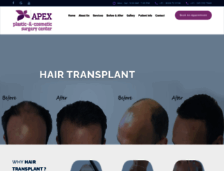 hairtransplantvadodara.in screenshot