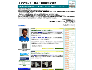 implant-blog.com screenshot