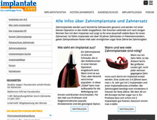 implantate.com screenshot