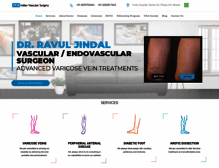 indianvascularsurgery.com screenshot