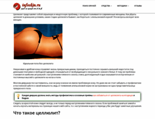 infoskin.ru screenshot