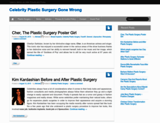 plastic-surgery-implants.com screenshot
