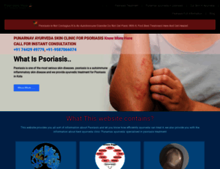 psoriasisheal.com screenshot