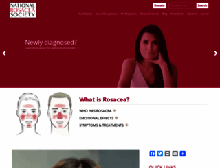 rosacea.org screenshot