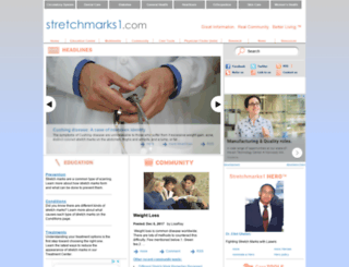 stretchmarks1.com screenshot