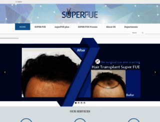 superfue.com screenshot