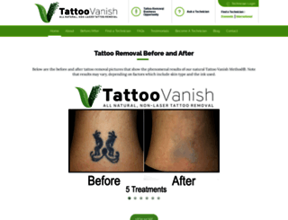 tattoovanishinc.com screenshot