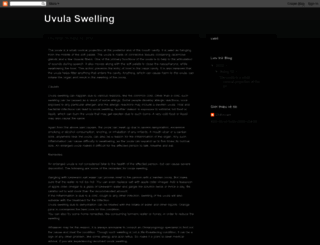 uvulaswelling.blogspot.com screenshot