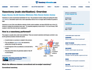 vasectomy-information.com screenshot