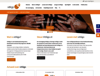 vitiligo.nl screenshot