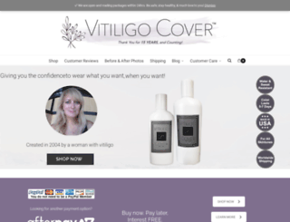 vitiligocover.com screenshot