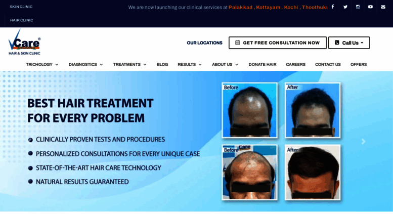 Access Vcaretrichology Com India S Most Trusted Hair Care Clinic